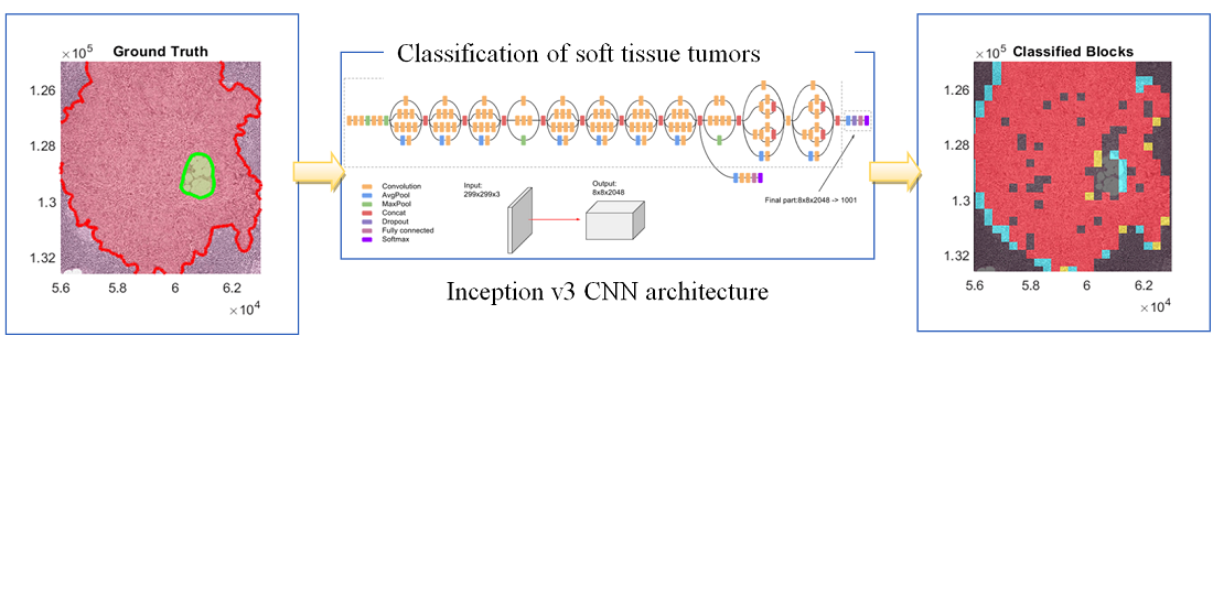Developing a convolutional neural network for classifying tumor images using Inception v3