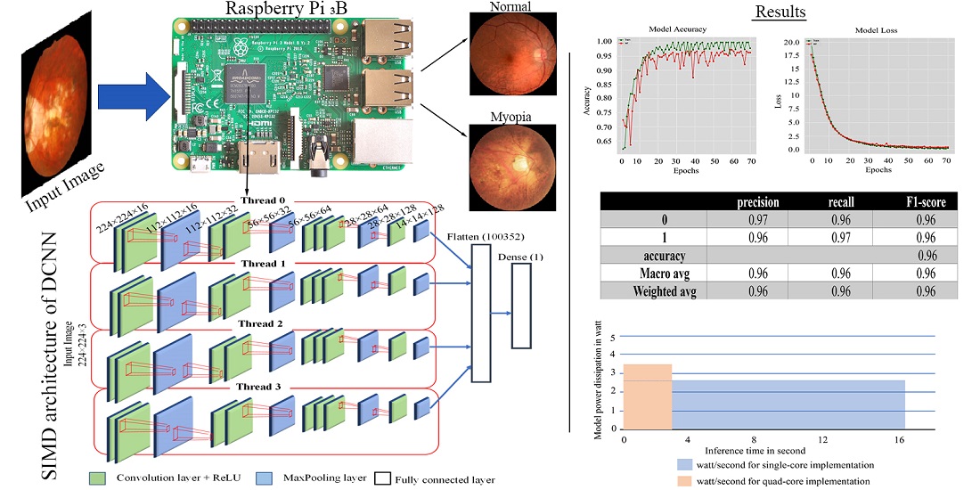 SIMD implementation of deep CNNs for myopia detection on a single-board computer system