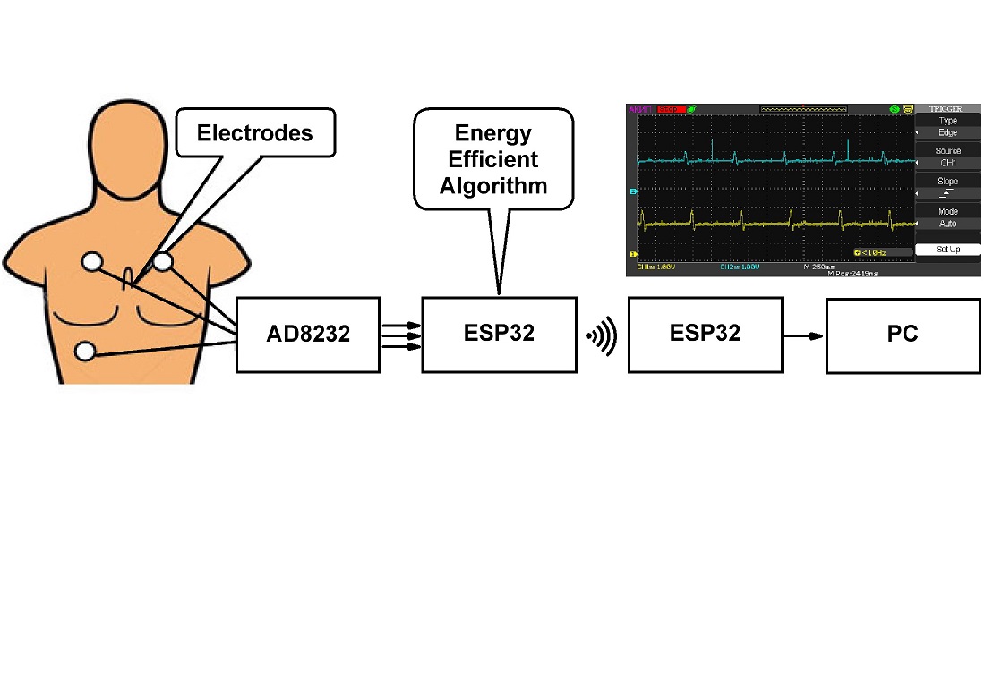 Hardware-software implementation of a local Wi-Fi network for the transmission of biomedical signals