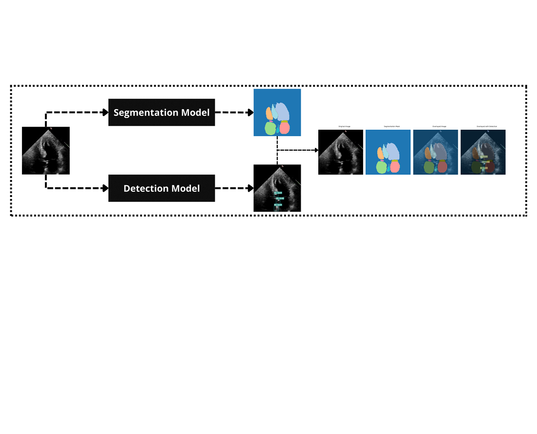 Advancing real-time echocardiographic diagnosis with a hybrid deep learning model