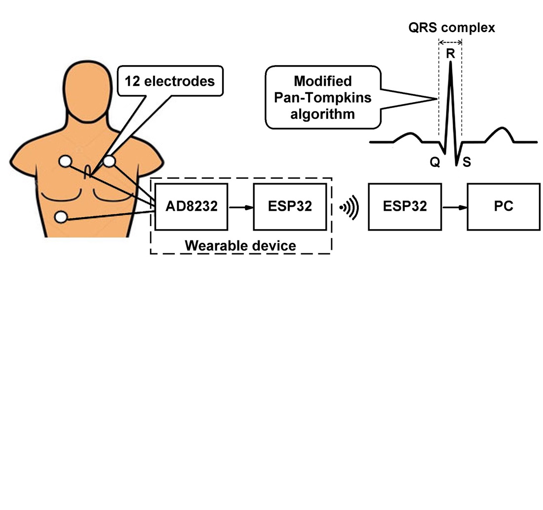 Automated real-time electrocardiogram diagnosis based on the modified Pan-Tompkins algorithm for long-term monitoring systems
