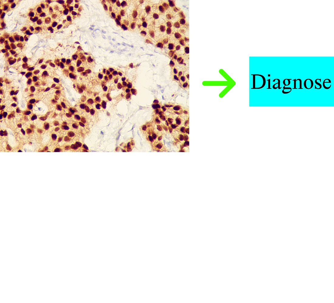 Devising a comprehensive approach to diagnosing breast cancer subtypes automatically based on deep neural networks